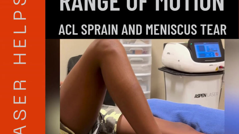 Laser ACL Sprain and Meniscus Tear